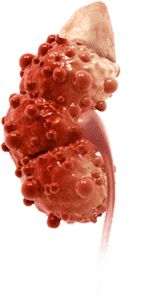 Sick kidney image